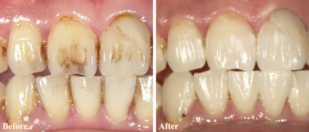 ���̃N���[�j���O�@���É�