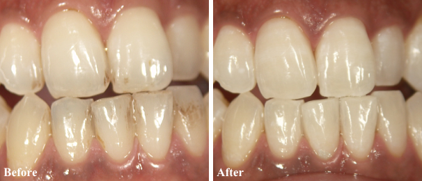 ���̃N���[�j���O�@���É�